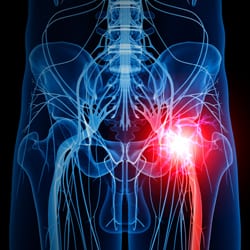 Sciatic Nerve
