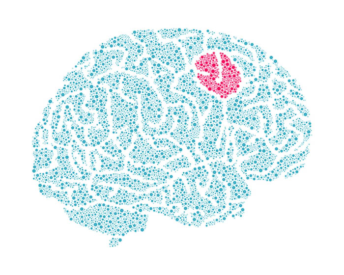 illustration of brain with tumor