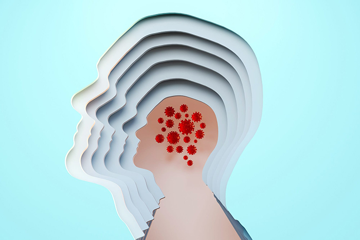 strokecovid2000x1333