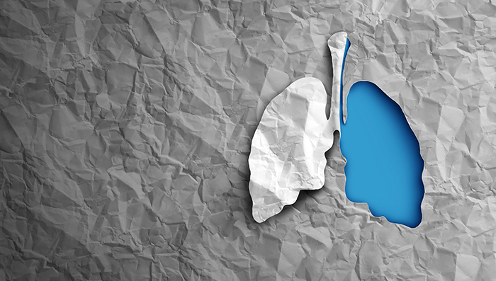 lung cancer bio marker