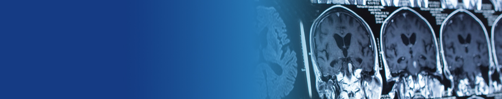 neurology-hero