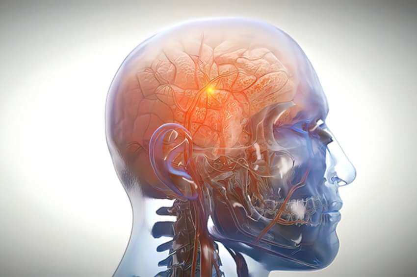 an illustration of a transparent human head showing the brain, bones and arteries inside