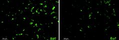 Image caption: Area covered by inflammatory microglia in the brain of Alzheimer’s disease mice without (left) and with EP2 targeting drug treatment (right)