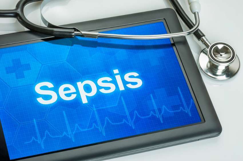 screen with the word Sepsis on it