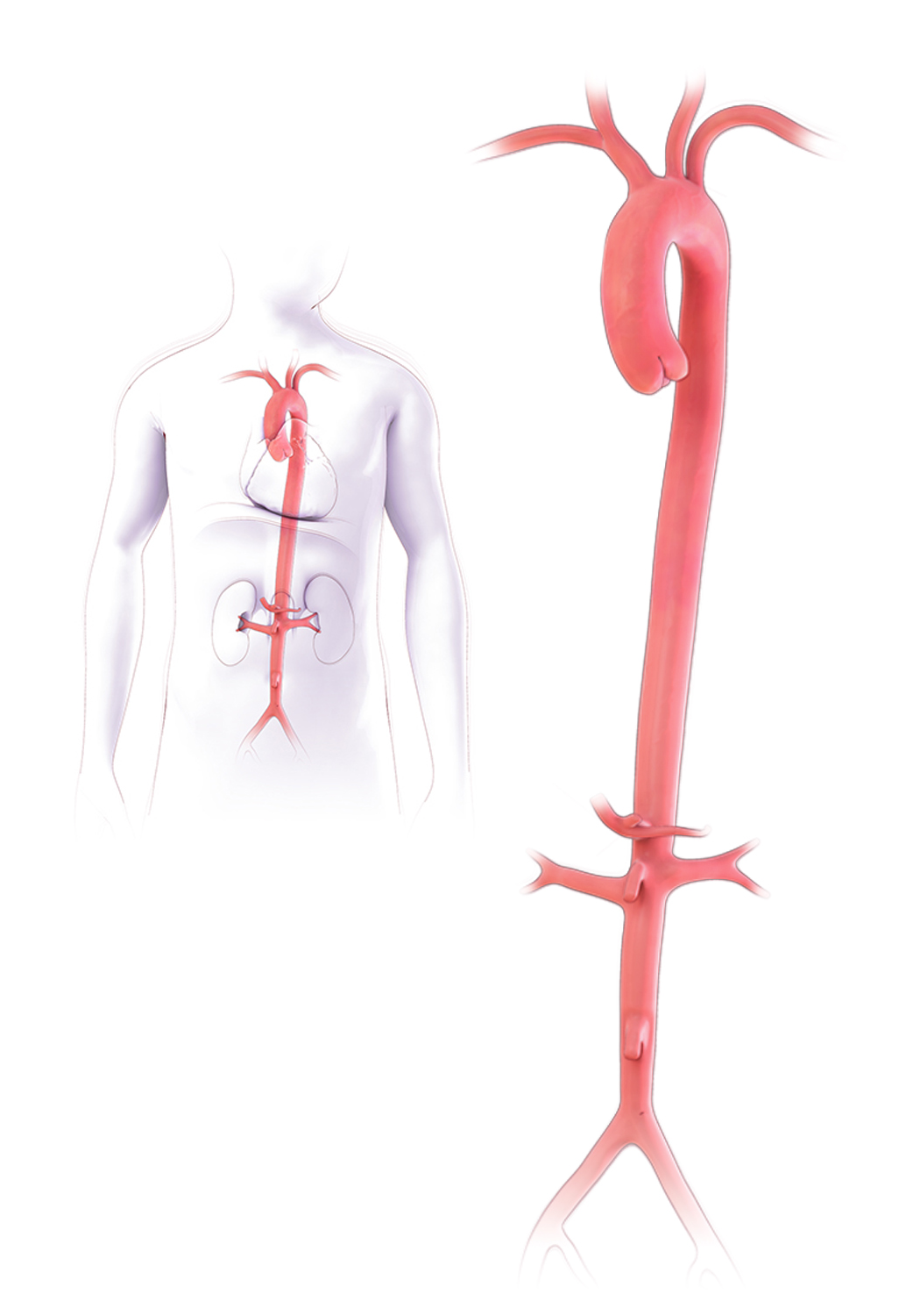 Figure 1: Healthy Aorta